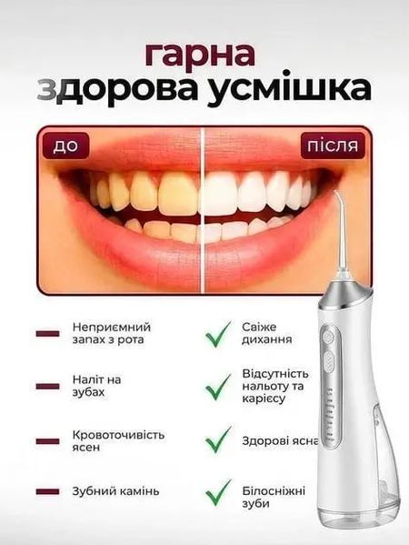 Ирригатор портативный для полости рта и чистки зубов id_990 фото